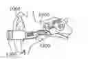 Fig. 01 - Ear wax removal device and methods thereof