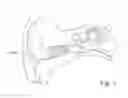 Fig. 02 - Ear wax removal device and methods thereof