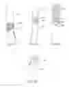 Fig. 06 - Ear wax removal device and methods thereof