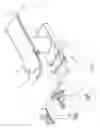 Fig. 02 - SURGICAL TABLE AND ACCESSORIES TO FACILITATE HIP ARTHROSCOPY