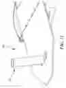 Fig. 12 - SURGICAL TABLE AND ACCESSORIES TO FACILITATE HIP ARTHROSCOPY
