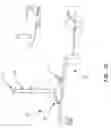 Fig. 27 - SURGICAL TABLE AND ACCESSORIES TO FACILITATE HIP ARTHROSCOPY