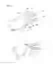 Fig. 13 - Apparatus for assisting in finger motion