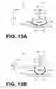 Fig. 10 - CPR chest compression machine adjusting motion-time profile in view of detected force