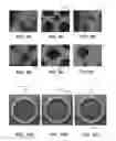 Fig. 09 - Geometrically complex intravaginal rings, systems and methods of making the same