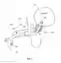 Fig. 02 - Urethral balloon dilator catheter