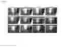 Fig. 06 - Crosslinked tubular foam