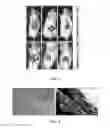 Fig. 04 - Thin film cell encapsulation devices