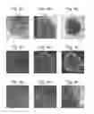 Fig. 08 - 3D Printing Of A Cellularised Scaffold