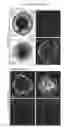 Fig. 04 - METHODS OF GENERATING HUMAN INNER EAR SENSORY EPITHELIA AND SENSORY NEURONS