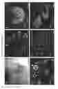 Fig. 10 - METHODS OF GENERATING HUMAN INNER EAR SENSORY EPITHELIA AND SENSORY NEURONS