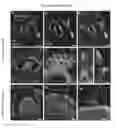 Fig. 12 - METHODS OF GENERATING HUMAN INNER EAR SENSORY EPITHELIA AND SENSORY NEURONS