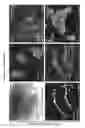 Fig. 14 - METHODS OF GENERATING HUMAN INNER EAR SENSORY EPITHELIA AND SENSORY NEURONS