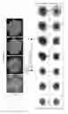 Fig. 20 - METHODS OF GENERATING HUMAN INNER EAR SENSORY EPITHELIA AND SENSORY NEURONS