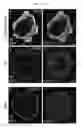 Fig. 22 - METHODS OF GENERATING HUMAN INNER EAR SENSORY EPITHELIA AND SENSORY NEURONS