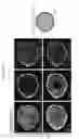 Fig. 23 - METHODS OF GENERATING HUMAN INNER EAR SENSORY EPITHELIA AND SENSORY NEURONS