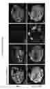 Fig. 24 - METHODS OF GENERATING HUMAN INNER EAR SENSORY EPITHELIA AND SENSORY NEURONS