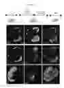 Fig. 25 - METHODS OF GENERATING HUMAN INNER EAR SENSORY EPITHELIA AND SENSORY NEURONS