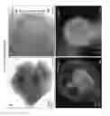 Fig. 29 - METHODS OF GENERATING HUMAN INNER EAR SENSORY EPITHELIA AND SENSORY NEURONS