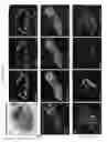 Fig. 30 - METHODS OF GENERATING HUMAN INNER EAR SENSORY EPITHELIA AND SENSORY NEURONS
