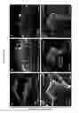 Fig. 35 - METHODS OF GENERATING HUMAN INNER EAR SENSORY EPITHELIA AND SENSORY NEURONS