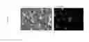 Fig. 84 - DEVICES AND METHODS FOR SIMULATING A FUNCTION OF A LIVER TISSUE
