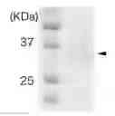 Fig. 01 - Nucleic acid encoding a luminescent enzyme protein