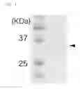 Fig. 02 - Nucleic acid encoding a luminescent enzyme protein