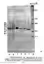 Fig. 01 - COMOSAIN AND BROMELAINS AS IMMUNO-THERAPY IN THE TREATING AND/OR PREVENTING VARIOUS TYPES OF CANCER IN A MAMMAL