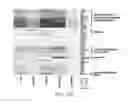 Fig. 72 - PURIFICATION PROCESS OF NASCENT DNA