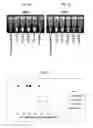 Fig. 02 - Detection of HIV-1 nucleic acids by reverse-transcription loop-mediated isothermal amplification