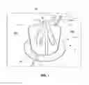 Fig. 02 - Tile Lippage Threaded Post