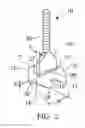 Fig. 03 - Tile Lippage Threaded Post