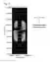 Fig. 23 - Liquid crystal display device