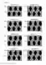 Fig. 63 - Liquid crystal display device