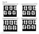 Fig. 82 - Liquid crystal display device