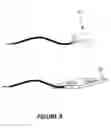 Fig. 08 - METAL ACCRETION BUS BARS