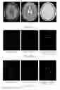 Fig. 07 - Iterative analyzing method for a medical image