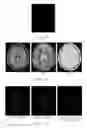 Fig. 08 - Iterative analyzing method for a medical image
