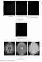 Fig. 09 - Iterative analyzing method for a medical image