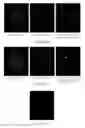 Fig. 10 - Iterative analyzing method for a medical image