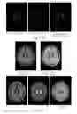Fig. 15 - Iterative analyzing method for a medical image