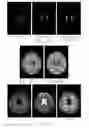 Fig. 16 - Iterative analyzing method for a medical image