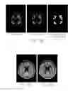 Fig. 17 - Iterative analyzing method for a medical image