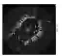 Fig. 04 - Detection of stent struts relative to side branches