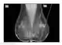 Fig. 01 - Systems and user interfaces for determination of electro magnetically identified lesions as included in medical images of differing perspectives