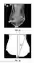 Fig. 02 - Systems and user interfaces for determination of electro magnetically identified lesions as included in medical images of differing perspectives