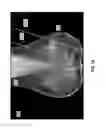 Fig. 08 - Systems and user interfaces for determination of electro magnetically identified lesions as included in medical images of differing perspectives