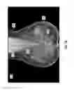Fig. 09 - Systems and user interfaces for determination of electro magnetically identified lesions as included in medical images of differing perspectives