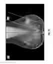 Fig. 10 - Systems and user interfaces for determination of electro magnetically identified lesions as included in medical images of differing perspectives